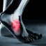 sports podiatrist north sydney