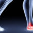 orthotic fitting specialist in sydney