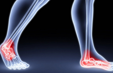 orthotic fitting specialist in sydney