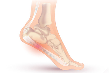 arch foot pain clinic sydney
